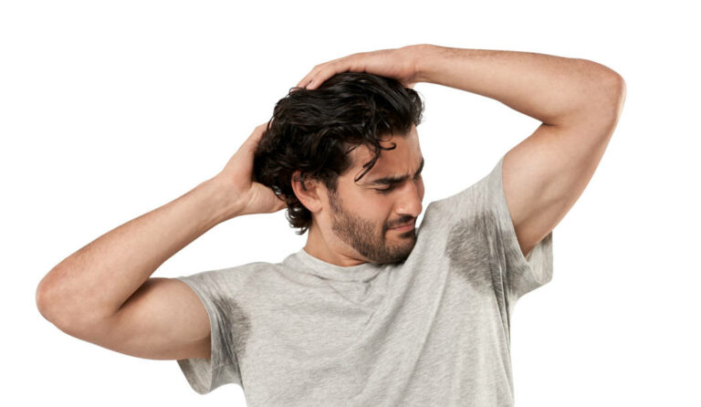 Dealing with Bromhidrosis: Understanding & Managing Body Odor